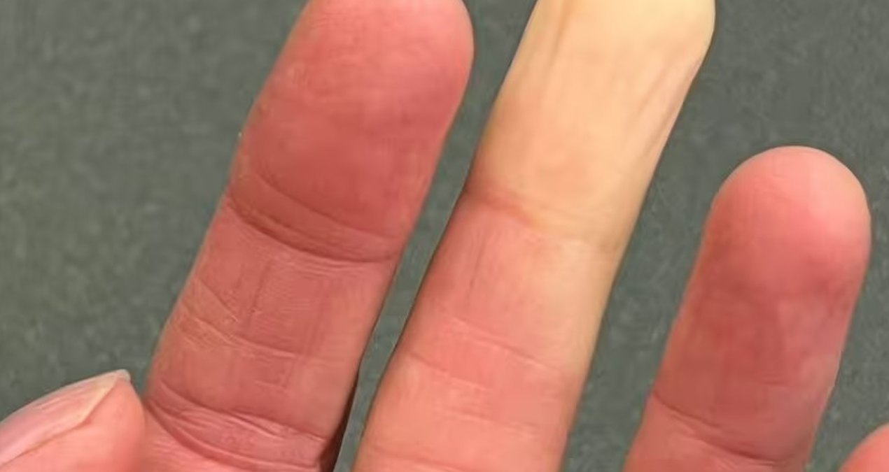 elleriniz ve ayaklariniz renk degistiriyorsa bunun tek nedeni useme degil XJaqLrYi.jpg