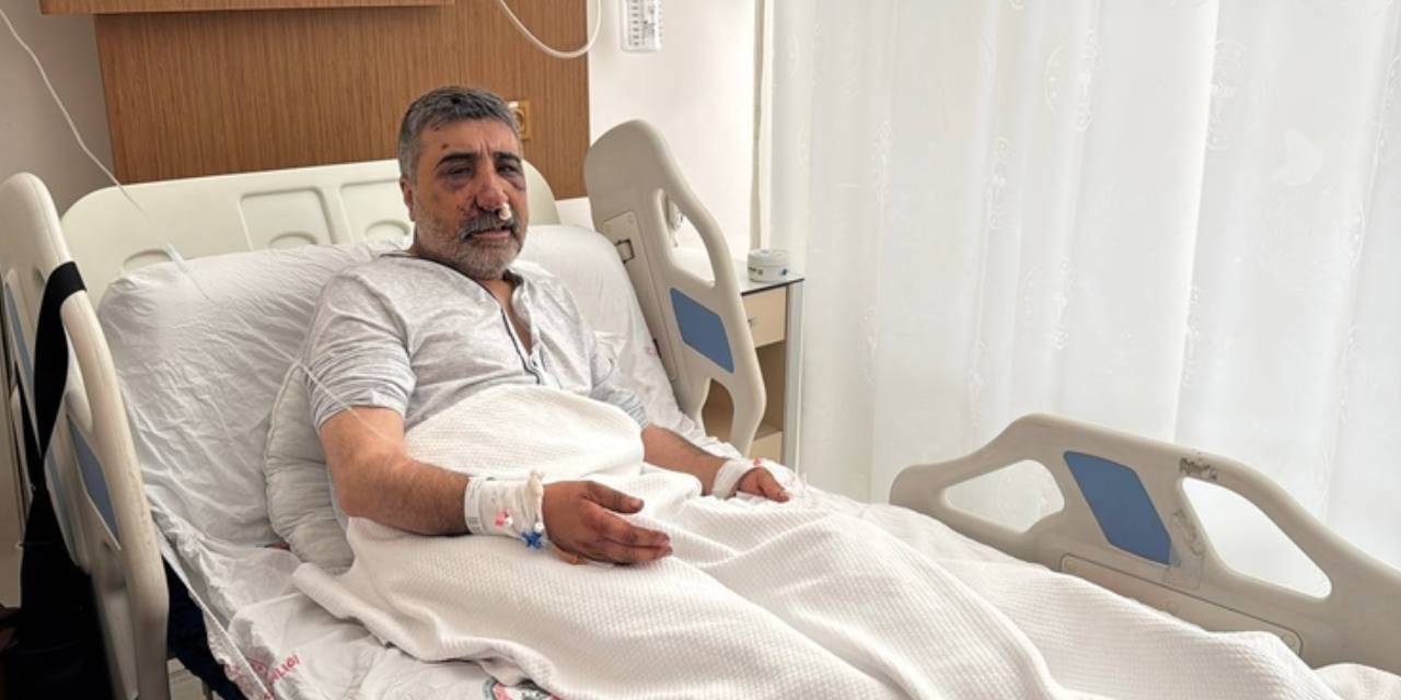 ingiliz boksorun darp ettigi taksicinin davasi goruldu geceleri bagirarak uyaniyorum iugfS5BY.jpg